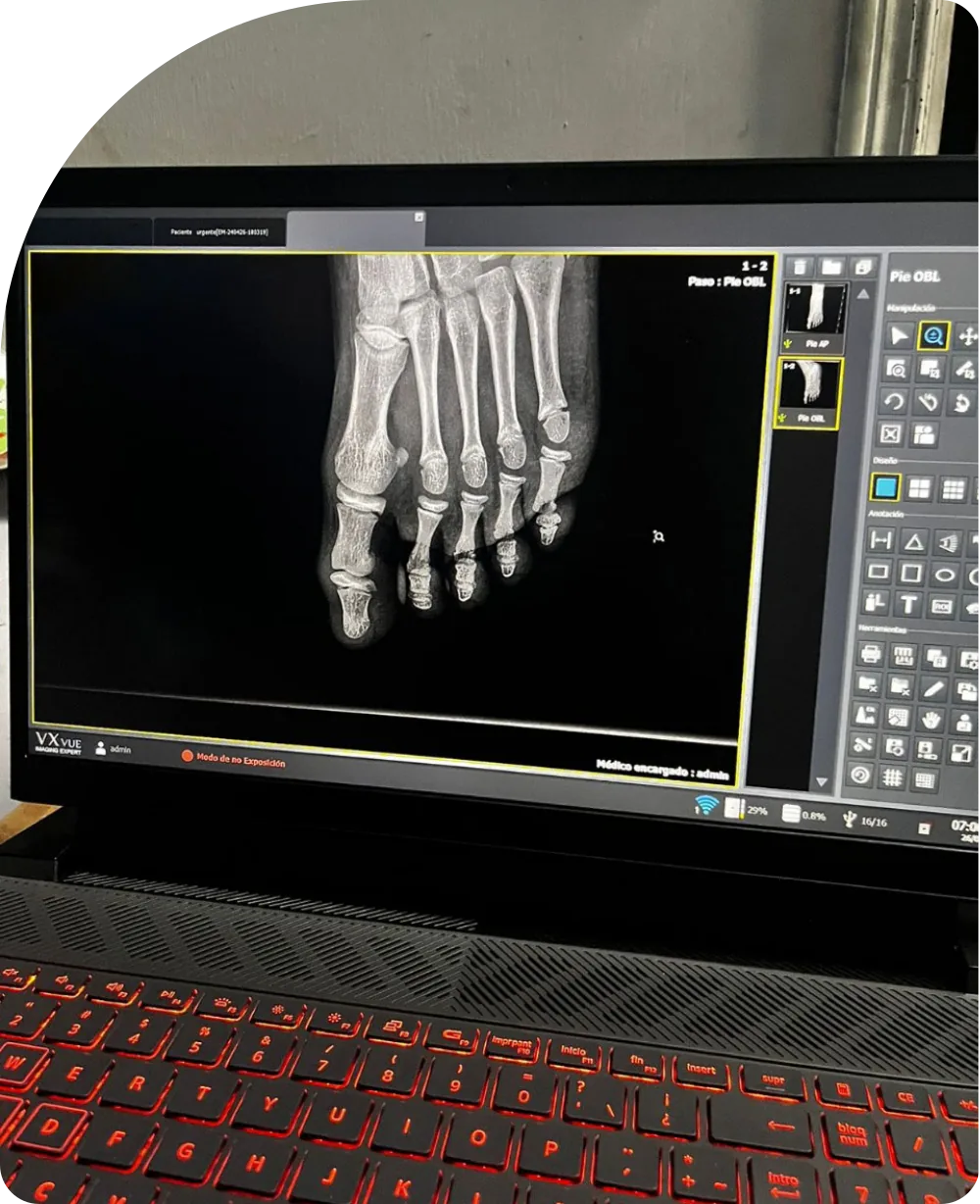 Aplicaciones clínicas del equipo de radiología en diferentes especialidades