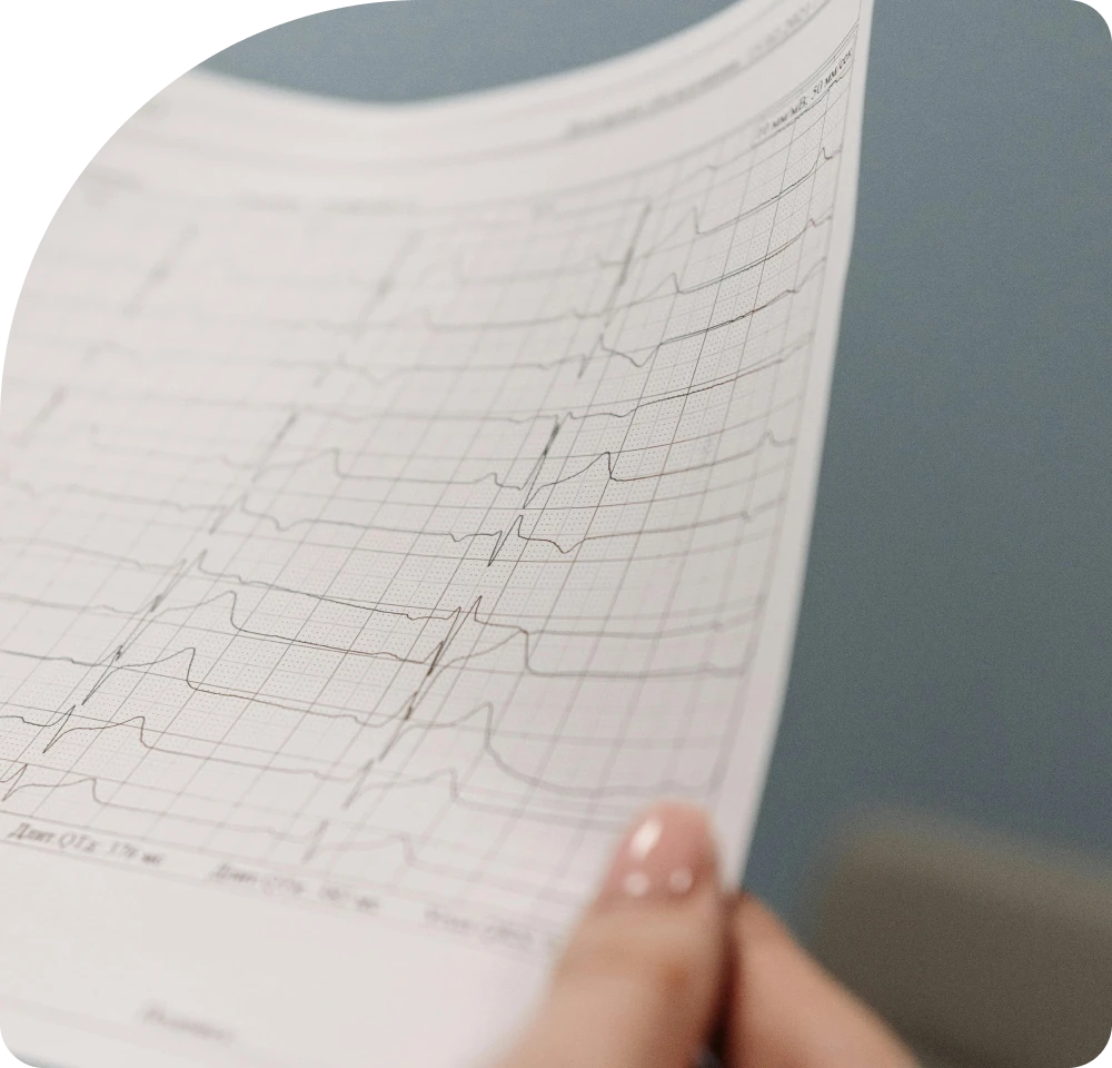 Beneficios de usar equipos de cardiología de alta tecnología