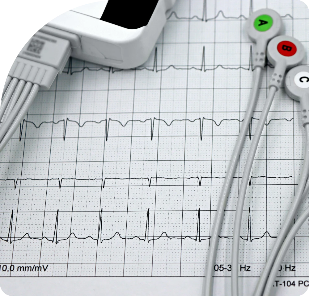 Beneficios de usar monitores médicos de última tecnología