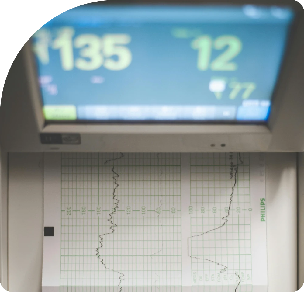Implementación de equipos de cardiología en consultorios y hospitales