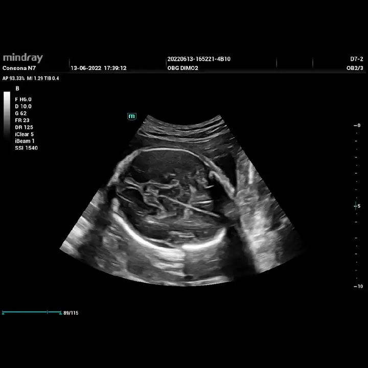 Ultrasonido Consona N7 Mindray: precisión diagnóstica y eficiencia clínica